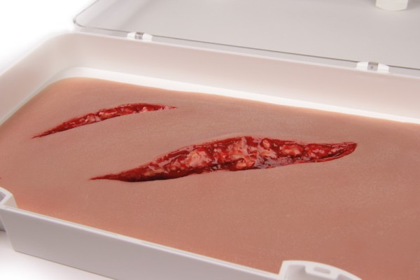 Schnittwunde groß, mit Blutungsfunktion